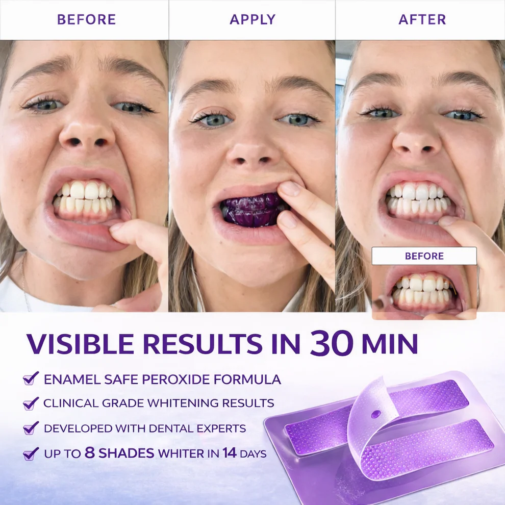SmileUp Teeth Whitening Strips
